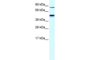 Western Blotting (WB) image for anti-erythrocyte Membrane Protein Band 4.2 (EPB42) antibody (ABIN2460809)