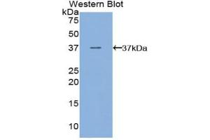 Western blot analysis of the recombinant protein. (FLT4 Antikörper  (AA 30-326))