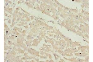 Immunohistochemistry of paraffin-embedded human heart tissue using ABIN7176063 at dilution of 1:100 (ZFYVE16 Antikörper  (AA 1-280))