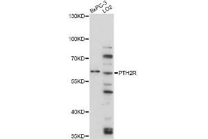Western blot analysis of extracts of various cell lines, using PTH2R antibody (ABIN6290771) at 1:3000 dilution. (PTH2R Antikörper)