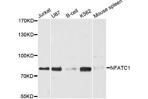 Western blot analysis of extracts of various cell lines, using NFATC1 antibody (ABIN5970728) at 1:3000 dilution. (NFATC1 Antikörper)