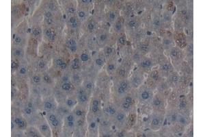 Immunohistochemistry (IHC) image for anti-ADAM Metallopeptidase with Thrombospondin Type 1 Motif, 2 (Adamts2) (AA 855-1030) antibody (ABIN7440095)