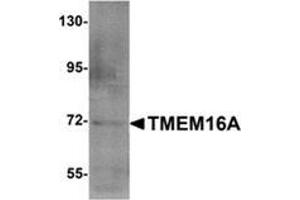 Western blot analysis of TMEM16A (arrow) in A549 cell lysate with TMEM16A Antibody  at 1 μg/ml. (ANO1 Antikörper  (N-Term))