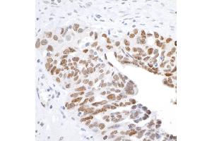 Immunohistochemistry (IHC) image for anti-H2A Histone Family, Member X (H2AFX) (C-Term) antibody (ABIN7449536)