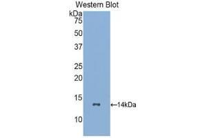 Western blot analysis of recombinant Human GCSFR. (CSF3R Antikörper  (AA 26-138))