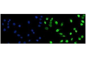 anti-FBJ Murine Osteosarcoma Viral Oncogene Homolog B (FOSB) (AA 1-332) antibody