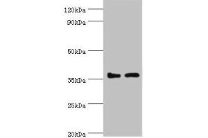 Western blot All lanes: BRCC3 antibody at 3 μg/mL Lane 1: 293T whole cell lysate Lane 2: MCF-7 whole cell lysate Secondary Goat polyclonal to rabbit IgG at 1/10000 dilution Predicted band size: 37, 34, 24, 29 kDa Observed band size: 37 kDa (BRCC3 Antikörper  (AA 1-316))