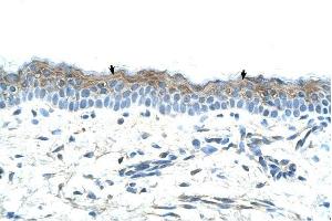 SERPINB5 antibody was used for immunohistochemistry at a concentration of 4-8 ug/ml to stain Squamous epithelial cells (arrows) in Human Skin. (SERPINB5 Antikörper)
