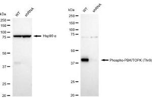 Western blotting analysis using Phospho-PBK/TOPK (Thr9) antibody (ABIN7799752). (Rekombinanter PBK Antikörper  (pThr9))