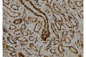ABIN6276587 at 1/100 staining Human kidney tissue by IHC-P. (PML Antikörper  (N-Term))