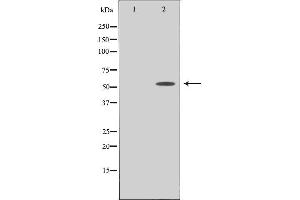 Western blot analysis of extracts from COLO cells using PPHLN antibody.