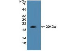 Western blot analysis of recombinant Human PPARd. (PPARD Antikörper  (AA 260-426))