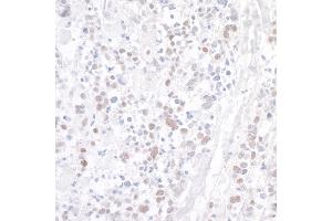 Immunohistochemistry (IHC) image for anti-WD Repeat Containing, Antisense To TP53 (WRAP53) (AA 1-50) antibody (ABIN7453892) (WRAP53 Antikörper  (AA 1-50))