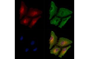 ABIN6258032 and ABIN6275061 staining  cells by IF/ICC.
