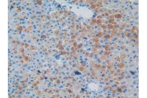 IHC-P analysis of Mouse Liver Tissue, with DAB staining. (MAPT Antikörper  (AA 92-400))