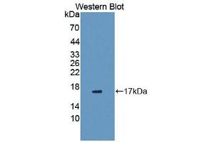 Western blot analysis of the recombinant protein. (VIPR1 Antikörper  (AA 34-146))