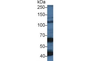 Western Blot; Sample: Porcine Cerebrum lysate; Primary Ab: 5µg/ml Rabbit Anti-Human OAS1 Antibody Second Ab: 0. (OAS1 Antikörper  (AA 74-165))