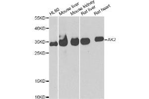 Western blot analysis of extracts of various cell lines, using AK2 antibody (ABIN5973904) at 1/1000 dilution. (Adenylate Kinase 2 Antikörper)