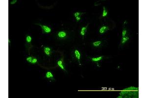 Immunofluorescence of monoclonal antibody to HDAC11 on HeLa cell. (HDAC11 Antikörper  (AA 1-347))