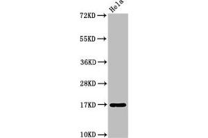 Western Blot Positive WB detected in: Hela whole cell lysate All lanes: C1D antibody at 3. (C1D Antikörper  (AA 1-135))
