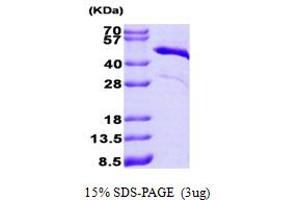 SDS-PAGE (SDS) image for Troponin T (Tn T) (AA 1-285) protein (His tag) (ABIN667741) (Troponin T Protein (Tn T) (AA 1-285) (His tag))