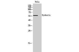 Western Blotting (WB) image for anti-Dyskeratosis Congenita 1, Dyskerin (DKC1) (Internal Region) antibody (ABIN3184375) (DKC1 Antikörper  (Internal Region))