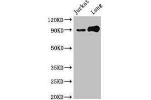 Western Blot Positive WB detected in: Jurkat whole cell lysate, Mouse lung tissue All lanes: STAT5B antibody at 2. (STAT5B Antikörper  (AA 40-280))