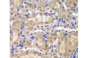 Immunohistochemistry of paraffin-embedded Mouse kidney using RPL5 Polyclonal Antibody at dilution of 1:200 (40x lens). (RPL5 Antikörper)