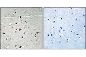 Immunohistochemistry (IHC) image for anti-LIM Domain Kinase 2 (LIMK2) (AA 249-298), (pSer283) antibody (ABIN1532018)
