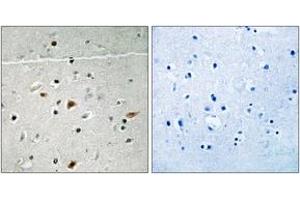 Immunohistochemistry analysis of paraffin-embedded human brain, using LIMK2 (Phospho-Ser283) Antibody. (LIMK2 Antikörper  (pSer283))