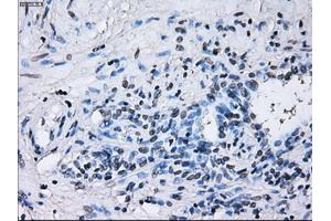 Immunohistochemical staining of paraffin-embedded Ovary tissue using anti-RNF144Bmouse monoclonal antibody. (RNF144B Antikörper  (AA 1-256))