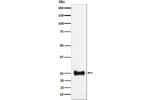 Western Blotting (WB) image for anti-Adenylate Kinase 4 (AK4) antibody (ABIN7606826)