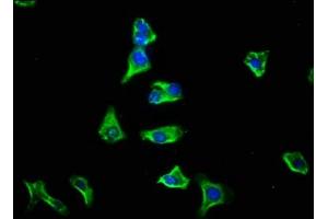 Immunofluorescence staining of HepG2 cells with ABIN7153371 at 1:133, counter-stained with DAPI.