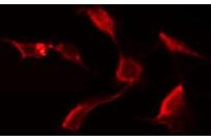 Immunofluorescence (fixed cells) (IF/ICC) image for anti-C-Type Lectin Domain Family 6, Member A (CLEC6A) (Internal Region) antibody (ABIN6260891)