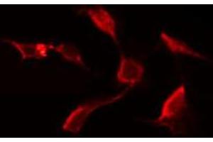ABIN6272657 staining Hela by IF/ICC. (C-Type Lectin Domain Family 6, Member A (CLEC6A) (Internal Region) Antikörper)
