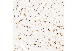 Immunohistochemistry of paraffin-embedded Mouse heart using SM/SNF5 antibody (ABIN7270657) at dilution of 1:1000 (40x lens). (SMARCB1 Antikörper)