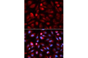 Immunofluorescence analysis of U2OS cell using ACP5 antibody. (ACP5 Antikörper  (AA 76-325))