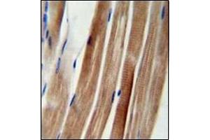 Immunohistochemistry analysis in formalin fixed and paraffin embedded human skeletal muscle reacted with KIAA1310 Antibody (Center) followed which was peroxidase conjugated to the secondary antibody and followed by DAB staining.