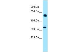Western Blotting (WB) image for anti-Inositol Hexakisphosphate Kinase 1 (IP6K1) (N-Term) antibody (ABIN2789109) (IP6K1 Antikörper  (N-Term))