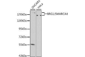 Western blot analysis of extracts of various cell lines, using BRG1/BRG1/SM antibody (ABIN6133730, ABIN6148100, ABIN6148101 and ABIN7101348) at 1:500 dilution. (SMARCA4 Antikörper  (AA 30-130))