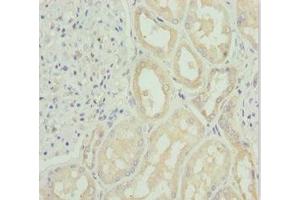 Immunohistochemistry of paraffin-embedded human kidney tissue using ABIN7171148 at dilution of 1:100 (SNAP29 Antikörper  (AA 1-258))