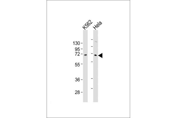 ZNF257 Antikörper  (C-Term)
