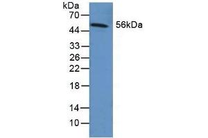 Detection of FGB in Human Liver Tissue using Polyclonal Antibody to Fibrinogen Beta Chain (FGB) (Fibrinogen beta Chain Antikörper  (AA 29-118))
