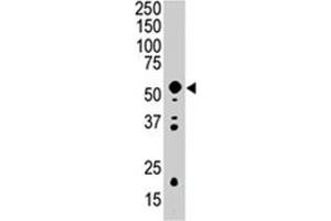 Western blot analysis of PDK2 polyclonal antibody  in mouse intestine tissue lysate (35 ug/lane). (PDK2 Antikörper  (AA 378-407))