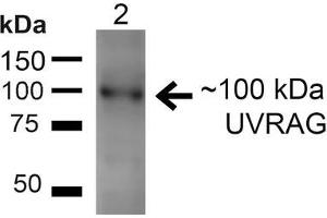 Western blot analysis of Rat Liver showing detection of ~100kDa UVRAG protein using Rabbit Anti-UVRAG Polyclonal Antibody . (UVRAG Antikörper  (HRP))