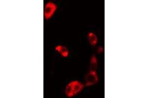 ABIN6274830 staining HuvEc cells by IF/ICC. (AKR1B1 Antikörper  (C-Term))