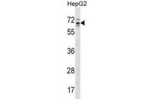 Western Blotting (WB) image for anti-rho GTPase Activating Protein 36 (ARHGAP36) antibody (ABIN2998590) (ARHGAP36 Antikörper)