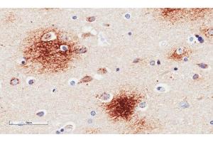 Immunohistochemical staining of human Alzheimer's disease hippocampus tissue using anti-Amyloid Beta antibody.