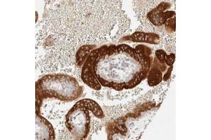 Immunohistochemical staining of human placenta with LETM2 polyclonal antibody  shows strong cytoplasmic positivity in trophoblastic cells at 1:200-1:500 dilution. (LETM2 Antikörper)