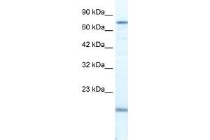 WB Suggested Anti-PGBD3 Antibody Titration:  2. (PGBD3 Antikörper  (N-Term))
